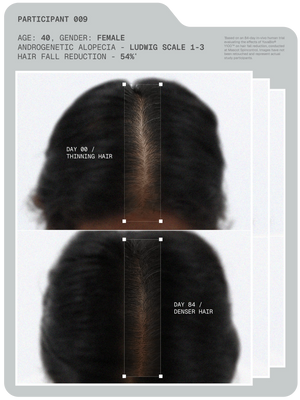Arata - MitoActive Hair Growth Serum + Anti-Dandruff Shampoo & Serum Combo – MitoActive results