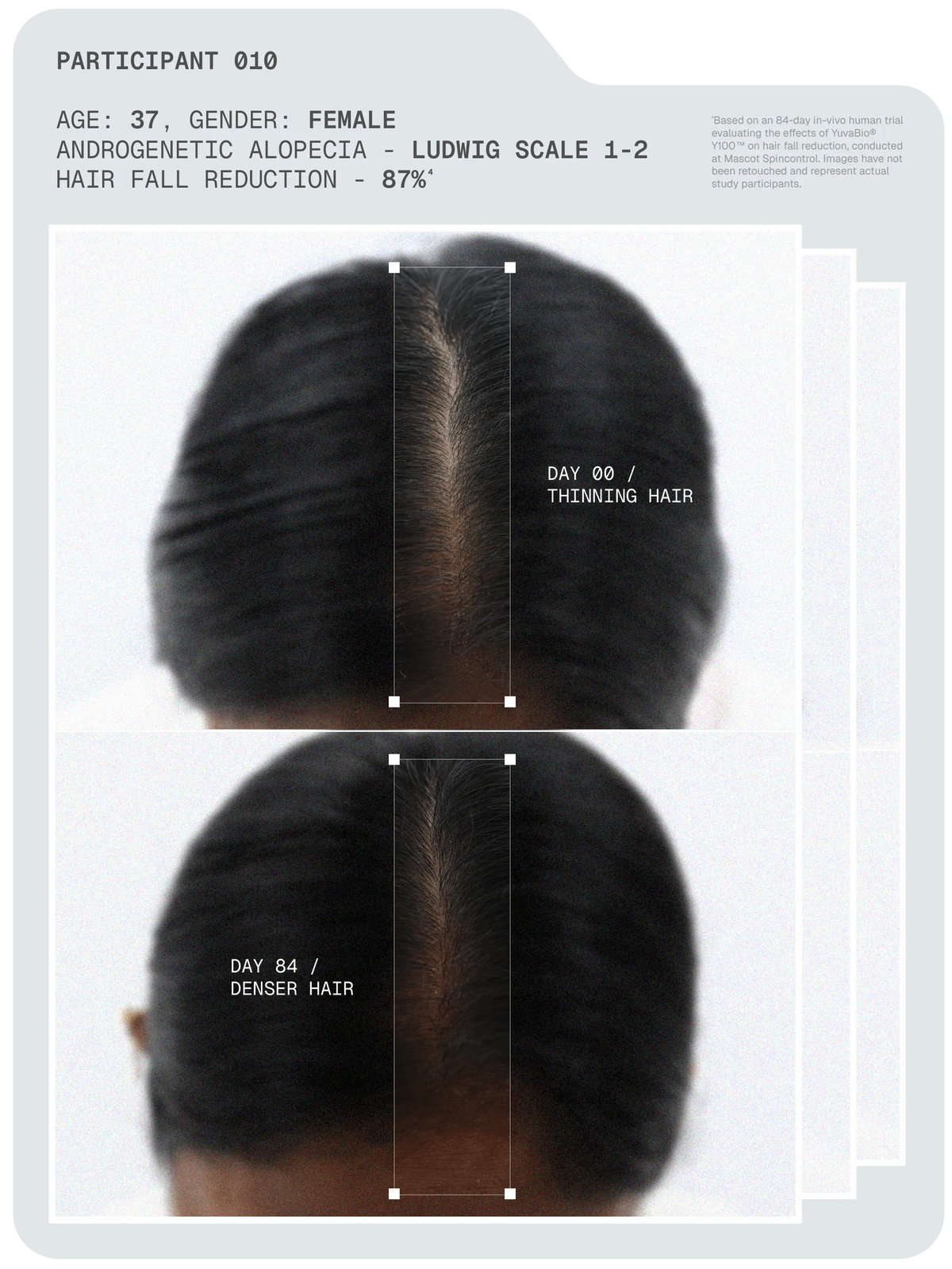 Arata - MitoActive Mitochondrial Hair Growth Serum 30ml Pack of 2 – how it works