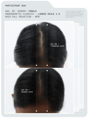 Arata - MitoActive Mitochondrial Hair Growth Serum 30ml – how it works