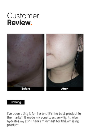 Minimilist - Alpha Arbutin 2% Face Serum 30ml - Zilion