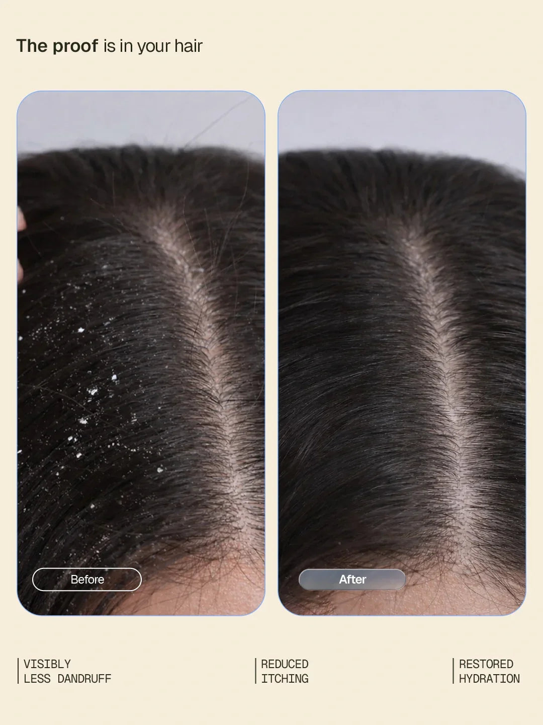 Arata - Anti-Dandruff Shampoo, Conditioner & Serum (Tonic) Combo – clinical results