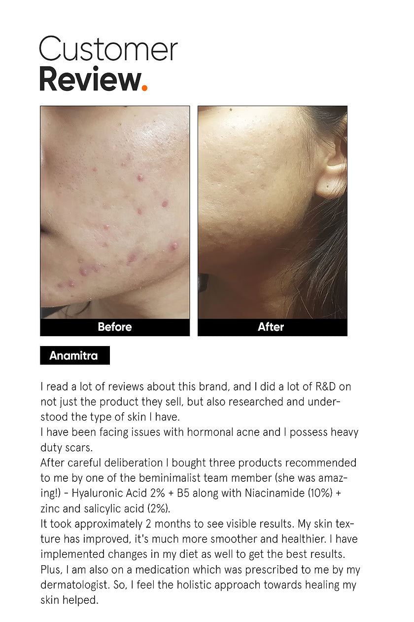 Minimilist - Hyaluronic + PGA 2% Face Serum 30ml - Zilion