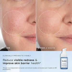 Medik8 - Niacinamide Peptides 30ml – product view 4