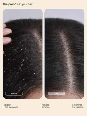 Arata - Anti-Dandruff Shampoo & Conditioner Combo
