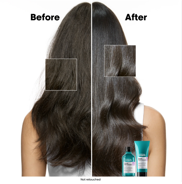 L'Oreal Professionnel - Scalp Advanced Anti-Discomfort Shampoo 1500ml – results